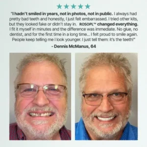 🔥 Don’t Miss Out! 70% OFF ROSOPL™ Custom Dentures for a Perfect, Confident Smile!
