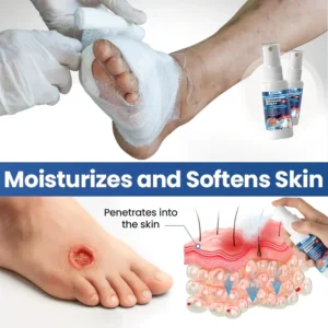 Alternative view of ROSOPL® GlycoHealth Barrier Spray