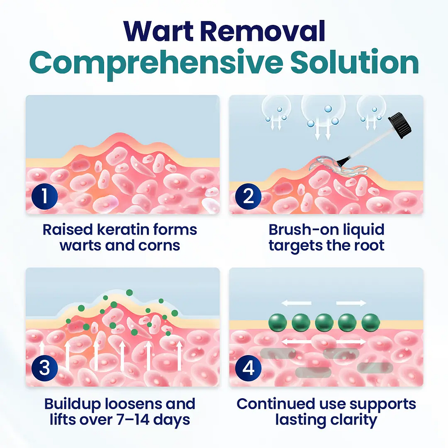 ROSOPL® Wart Lift Wart Removal Liquid - Image 2